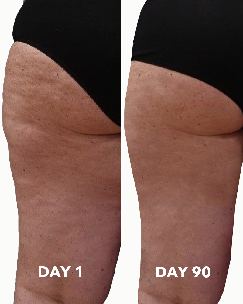 Cellu-Lite Anti-Cellulite Oil