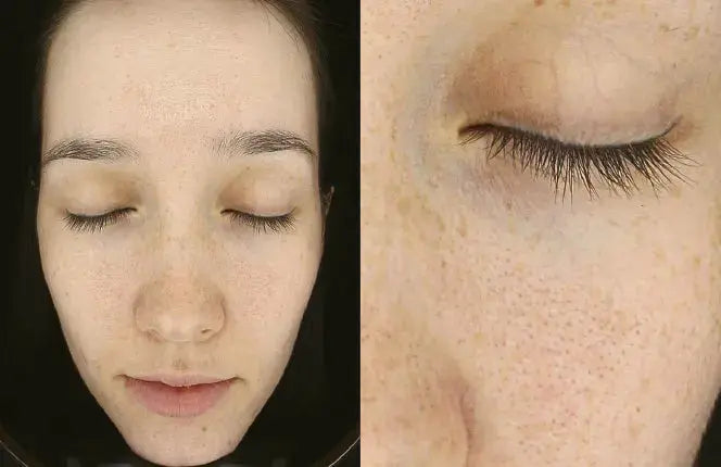 Derma-Vu Photographic Skin Analysis Machine With AI Technology