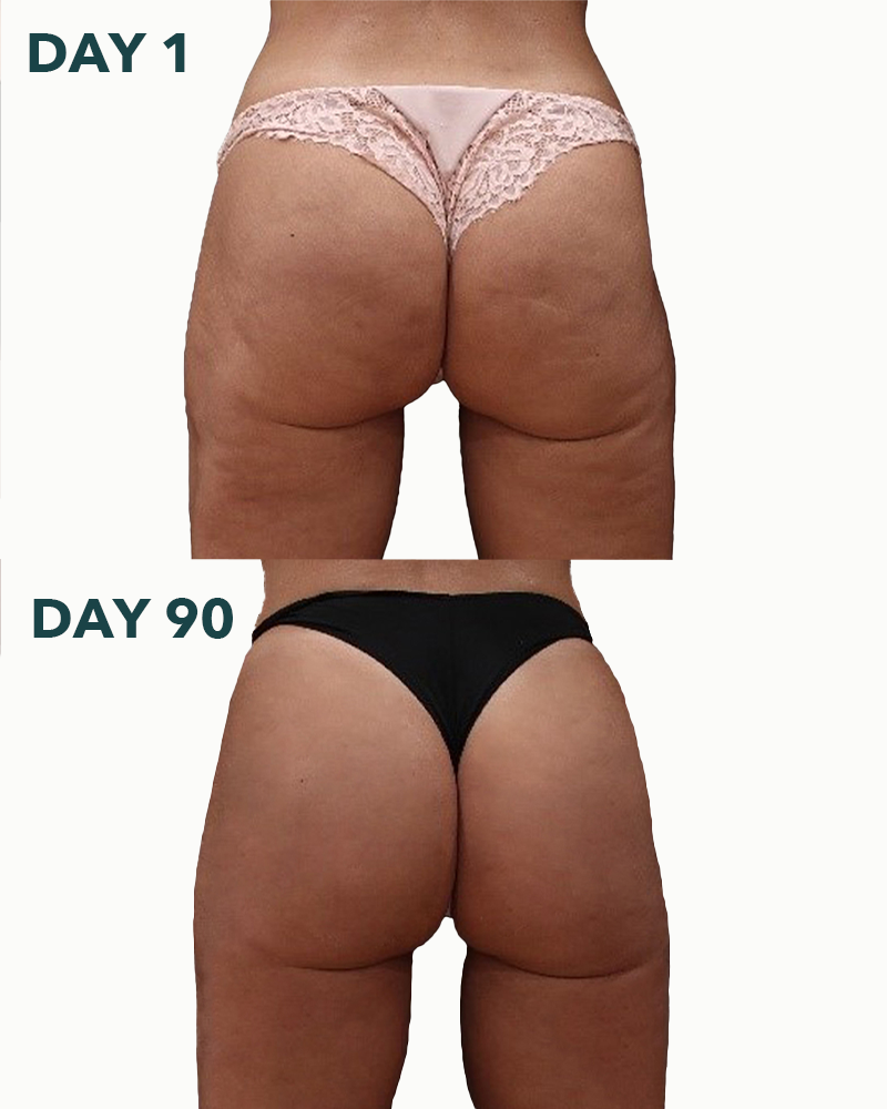 Peach-Lite Derrière Firming Cream