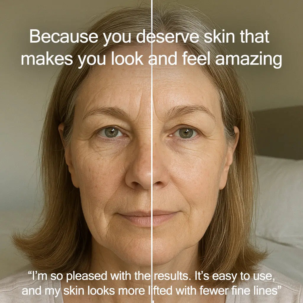 Radiance Pod Deluxe Set. Skin Lifting & Tightening Tool Plus Face-Up Gliding Gel