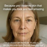 Radiance Pod Deluxe Set. Skin Lifting & Tightening Tool Plus Face-Up Gliding Gel