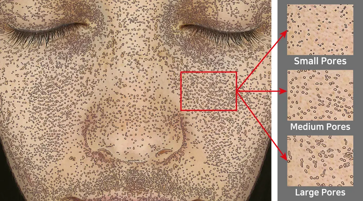 Derma-Vu Photographic Skin Analysis Machine With AI Technology