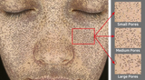 Derma-Vu Photographic Skin Analysis Machine With AI Technology