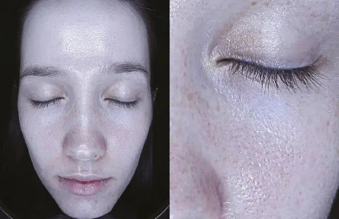 Derma-Vu Photographic Skin Analysis Machine With AI Technology