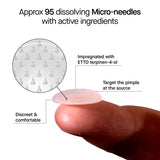 Acne Micro-Dart Patches