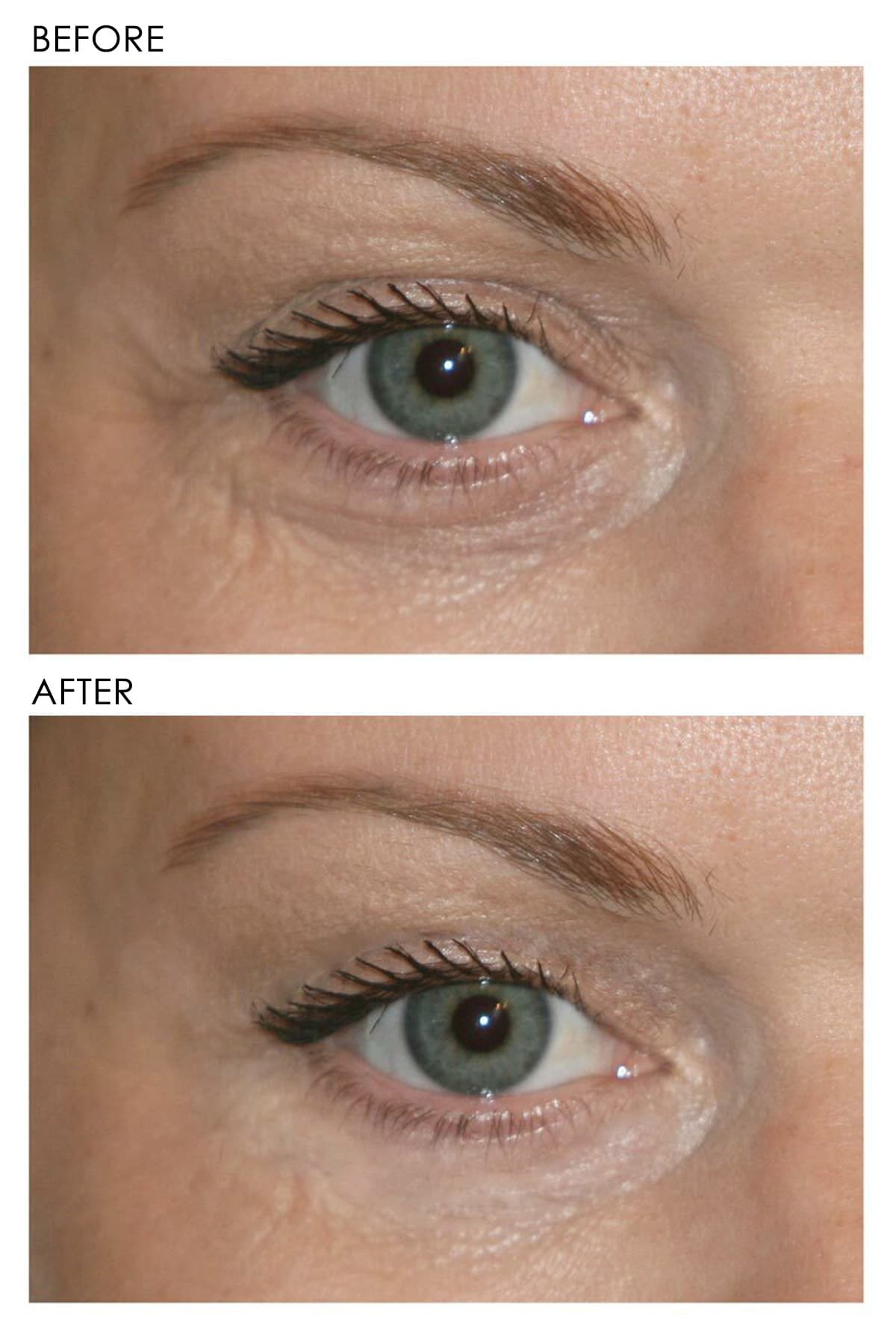 Revitalite Eyelid and Dark Circle Corrector