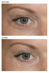 Revitalite Eyelid and Dark Circle Corrector