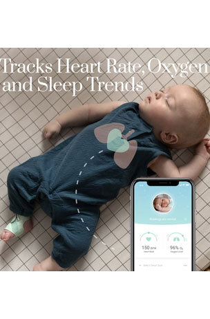Owlet Smart Sock Baby Monitor 3